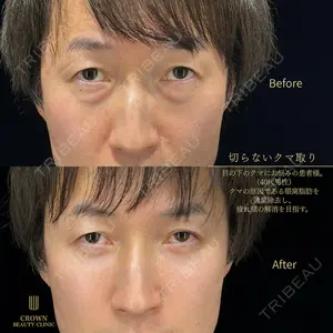 CROWN BEAUTY CLINIC 神山 豊医師の症例