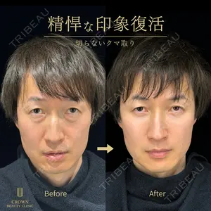 CROWN BEAUTY CLINIC 神山 豊医師の症例