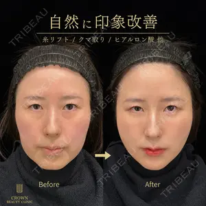CROWN BEAUTY CLINIC 神山 豊医師の症例