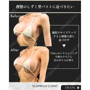 GLAMRULE CLINIC (グラムルール クリニック) 銀座院 藤林 万里子医師の症例