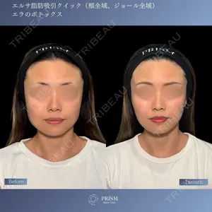 PRISM Beauty Clinic 新宿院 畑山 知輝医師の症例