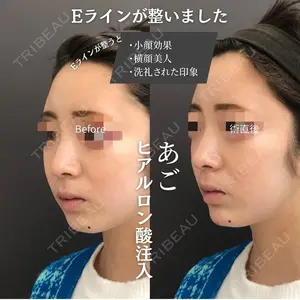 ロレシー美容クリニック 心斎橋駅前院 福留院長医師の症例