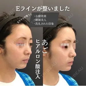 ロレシー美容クリニック 心斎橋駅前院 福留院長医師の症例