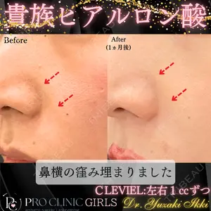 PRO CLINIC プロクリニック 銀座院 柚﨑 一輝医師の症例