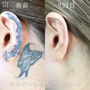 ziz CLINIC 村岡 史子医師の症例