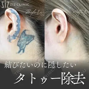 ziz CLINIC 村岡 史子医師の症例