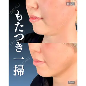 神戸美容外科 ネビュラクリニック 岩﨑 雅医師の症例