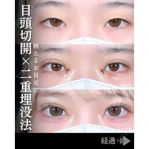 東京シンデレラ美容外科 池袋院 石井 達也医師の症例