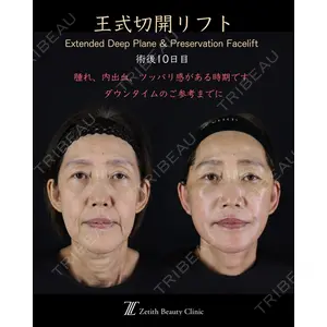 Zetith Beauty Clinic 新宿院 王 蘇医師の症例