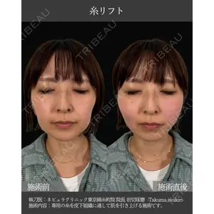 ネビュラクリニック 東京錦糸町院 岩切 琢磨医師の症例