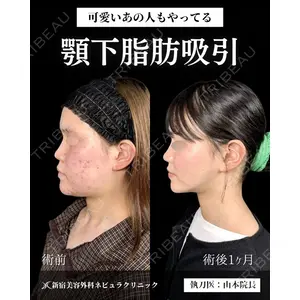 新宿美容外科ネビュラクリニック 山本 紘子医師の症例