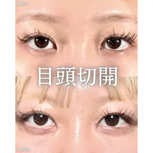 新宿美容外科ネビュラクリニック 山本 紘子医師の症例