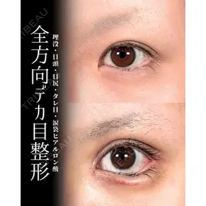新宿美容外科ネビュラクリニック 山本 紘子医師の症例