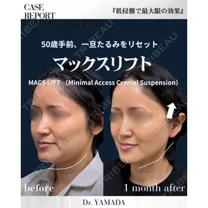 春山記念病院 山田 浩之医師の症例
