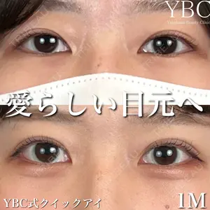 YBC横浜美容外科 池袋院 磯村 亮輔医師の症例