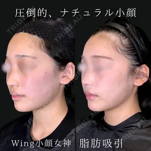 Wing clinic 豊中駅前院 速水 翼医師の症例