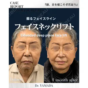 春山記念病院 山田 浩之医師の症例