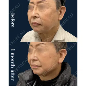春山記念病院 山田 浩之医師の症例