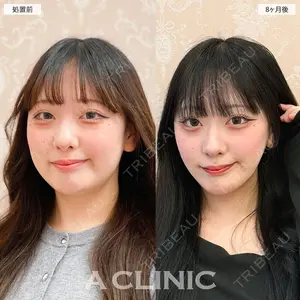 A CLINIC（エークリニック） 大阪院 田窪 賢志郎医師の症例