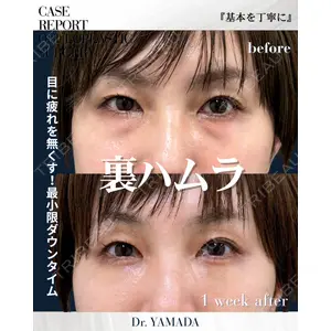 春山記念病院 山田 浩之医師の症例
