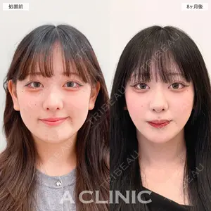 A CLINIC（エークリニック） 大阪院 田窪 賢志郎医師の症例