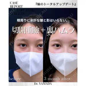 春山記念病院 山田 浩之医師の症例