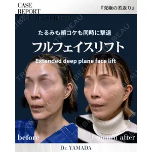 春山記念病院 山田 浩之医師の症例