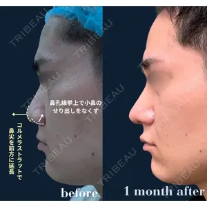 春山記念病院 山田 浩之医師の症例
