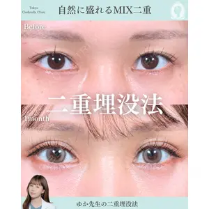 東京シンデレラ美容外科 新宿院 宮﨑友伽医師の症例