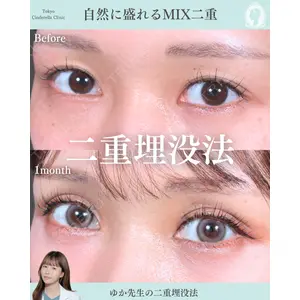 東京シンデレラ美容外科 新宿院 宮﨑友伽医師の症例