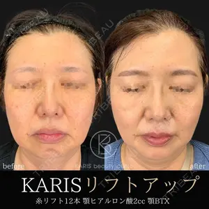 KARIS beauty clinic 滝内 ヒロフミ医師の症例