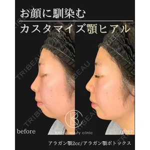 KARIS beauty clinic 滝内 ヒロフミ医師の症例