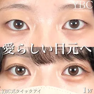 YBC横浜美容外科 池袋院 磯村 亮輔医師の症例