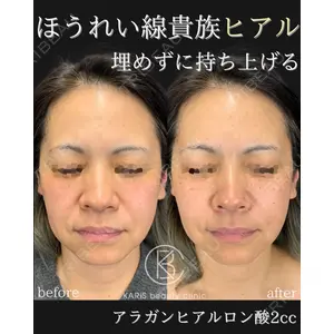 KARIS beauty clinic 滝内 ヒロフミ医師の症例