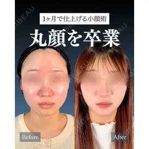 神戸美容外科 ネビュラクリニック 岩﨑 雅医師の症例