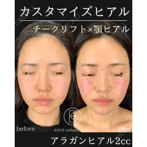 KARIS beauty clinic 滝内 ヒロフミ医師の症例