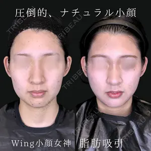 Wing clinic 豊中駅前院 速水 翼医師の症例