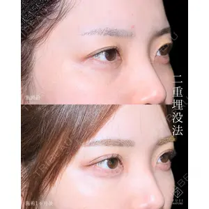 藤・ナチュレ美容クリニック 銀座院 小川 杏平医師の症例