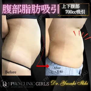 PRO CLINIC プロクリニック 銀座院 柚﨑 一輝医師の症例