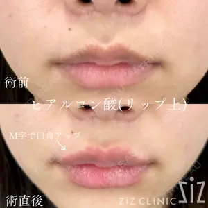 ziz CLINIC 村岡 史子医師の症例