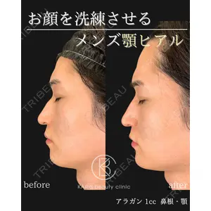 KARIS beauty clinic 滝内 ヒロフミ医師の症例