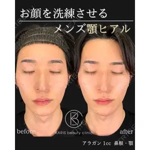 KARIS beauty clinic 滝内 ヒロフミ医師の症例