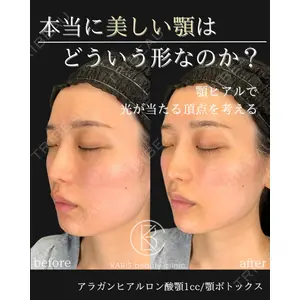 KARIS beauty clinic 滝内 ヒロフミ医師の症例