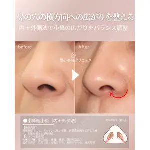 聖心美容クリニック 福岡院 權藤 理絵医師の症例