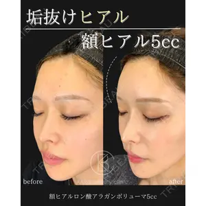 KARIS beauty clinic 滝内 ヒロフミ医師の症例