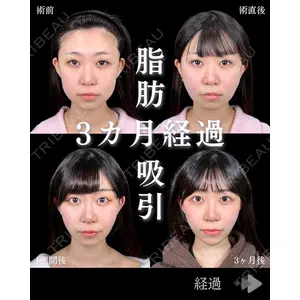 東京シンデレラ美容外科 池袋院 石井 達也医師の症例