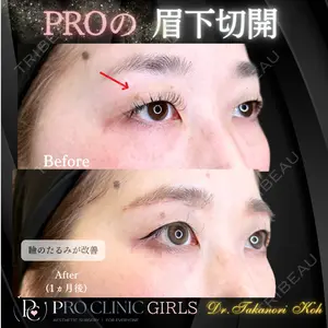 PRO CLINIC プロクリニック 銀座院 洪 嵩典医師の症例
