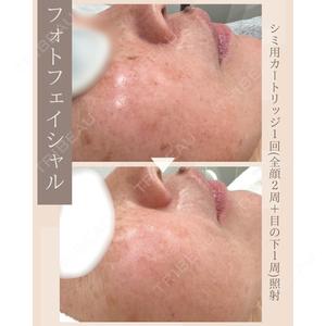 ROHE CLINIC GINZAの症例