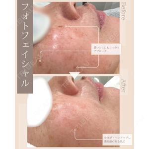 ROHE CLINIC GINZAの症例