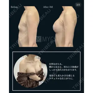 MYCLI【マイクリ】大阪・梅田院 三木 晶森医師の症例